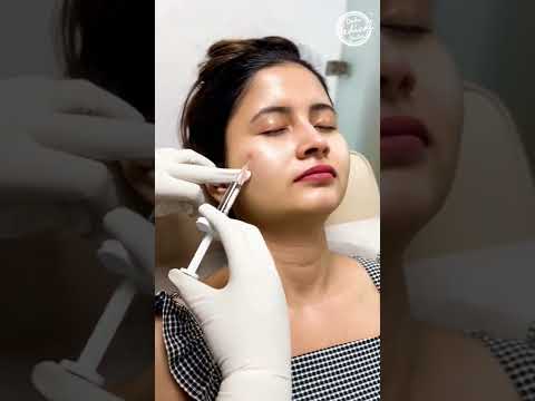 Profhilo Treatment | Anti-Aging Treatment | #profhilo #antiaging #shorts #youtubeshorts