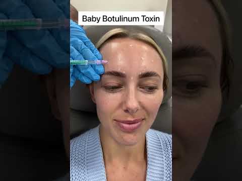 Baby BOTOX at DR MEDISPA